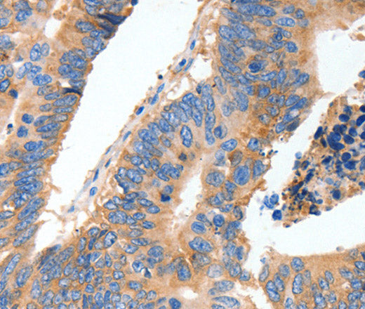 Anti-Human MUC6 Antibody - ABMIUM