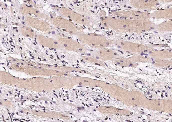 Anti-Human STUB1 Antibody [A1229] - ABMIUM