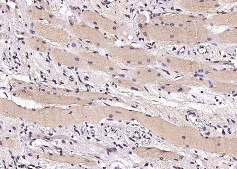 Anti-Human STUB1 Antibody [A1229] - ABMIUM