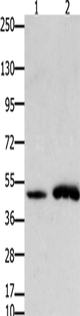 Anti-Human/Mouse FOXL2 Antibody - ABMIUM
