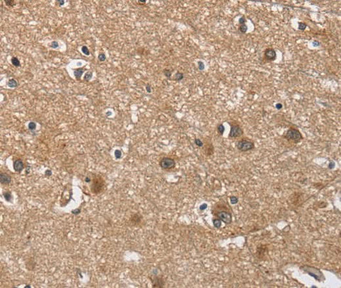 Anti-Human BUB1 Antibody - ABMIUM