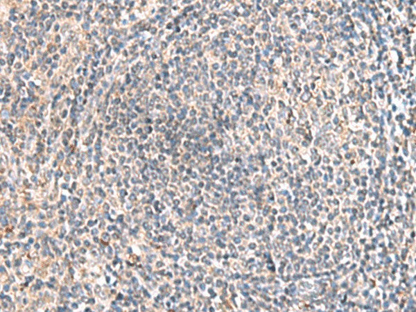 Immunohistochemistry of paraffin-embedded Human tonsil tissue using HLA-DOB Polyclonal Antibody at dilution of 1:45(×200)
