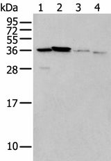 Western blot analysis of 293T cell Mouse brain tissue and Human kidney tissue lysates using LASP1 Polyclonal Antibody at dilution of 1:350