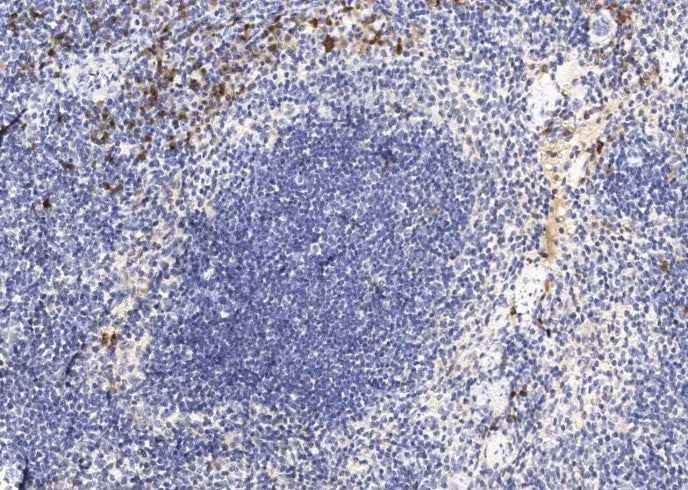 Anti-Mouse IL12B Antibody [A1102] - ABMIUM