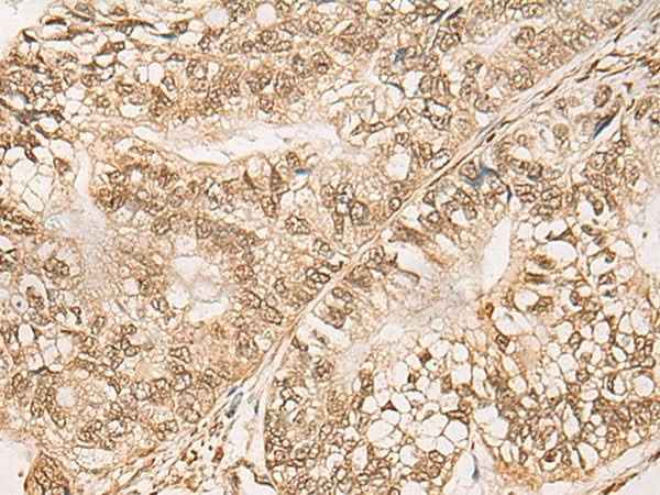 Anti-Human/Mouse/Rat WEE1 Antibody