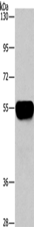 Anti-Human AHSG Antibody - ABMIUM