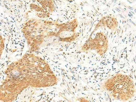 Anti-Human/Mouse TBPL1 Antibody