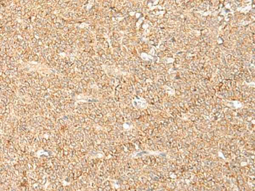 Anti-Human/Mouse LGALSL Antibody