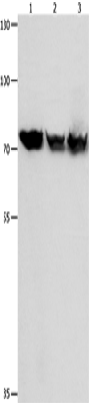 Anti-Human/Mouse/Rat TRAP1 Antibody - ABMIUM