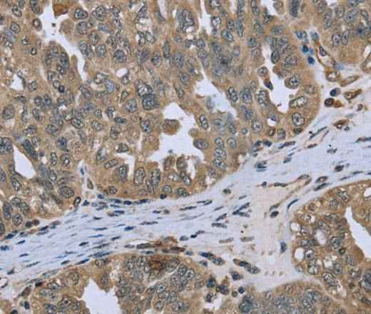 Anti-Human/Mouse/Rat DCTN4 Antibody