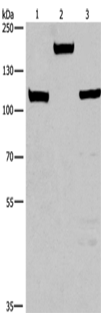 Anti-Human/Mouse TP53BP2 Antibody - ABMIUM