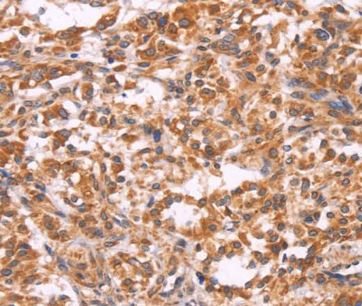 Anti-Human EMP2 Antibody - ABMIUM