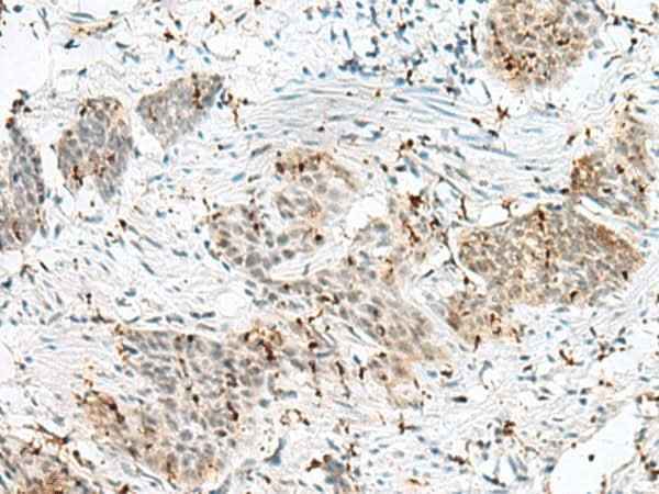 Anti-Human/Mouse PLCL2 Antibody