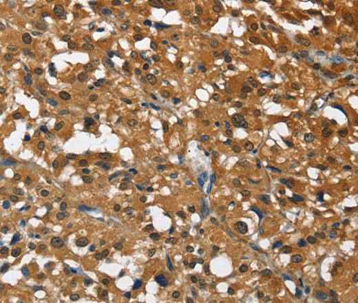 Anti-Human/Mouse/Rat DRAK2 Antibody