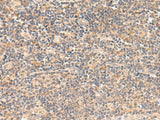 Immunohistochemistry of paraffin-embedded Human tonsil tissue using TEAD3 Polyclonal Antibody at dilution of 1:50(×200)