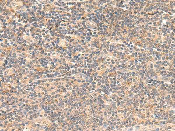 Anti-Human/Mouse TEAD3 Antibody