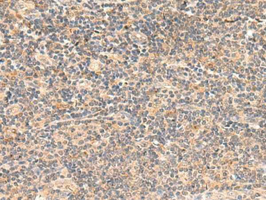 Anti-Human/Mouse TEAD3 Antibody