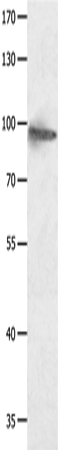 Anti-Human/Mouse/Rat HCN1 Antibody - ABMIUM