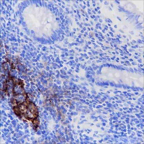 Anti-Human CD35 Antibody [A171] - ABMIUM