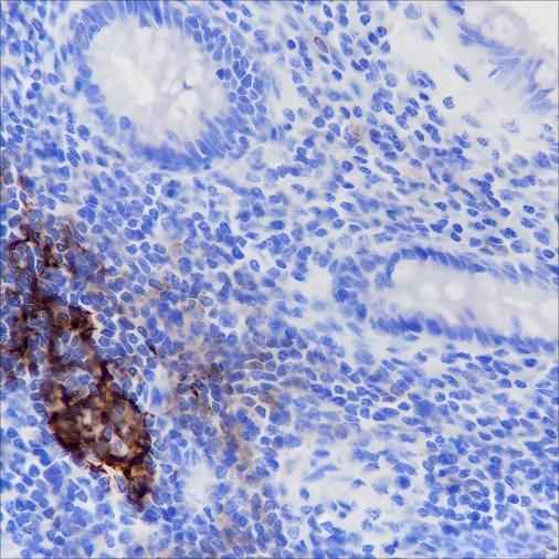 Anti-Human CD35 Antibody [A171] - ABMIUM
