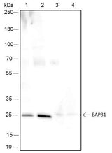 Anti-Human/Rat/Mouse BAP31 Antibody [A138]