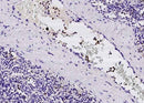 Anti-Human FCN1 Antibody [A960] - ABMIUM