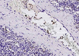 Anti-Human FCN1 Antibody [A960] - ABMIUM