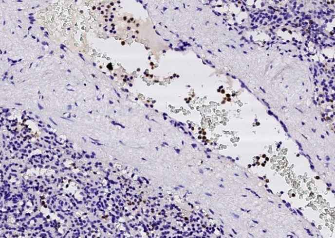 Anti-Human FCN1 Antibody [A960] - ABMIUM