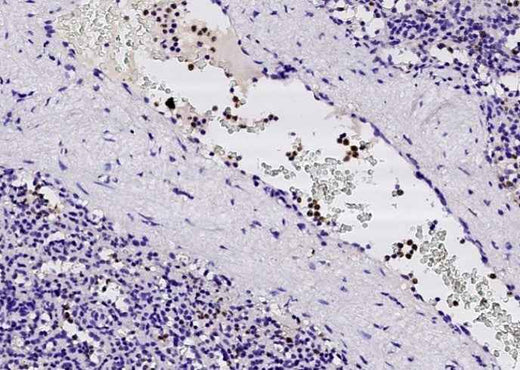 Anti-Human FCN1 Antibody [A960] - ABMIUM