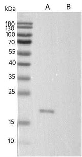 Anti-Human CLDN6 Antibody [A1097] - ABMIUM