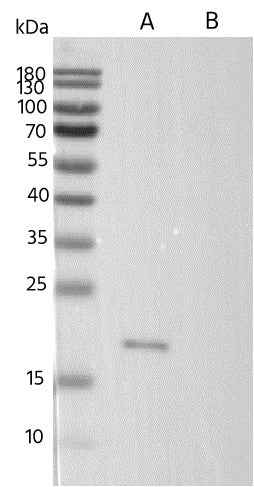Anti-Human CLDN6 Antibody [A1097] - ABMIUM