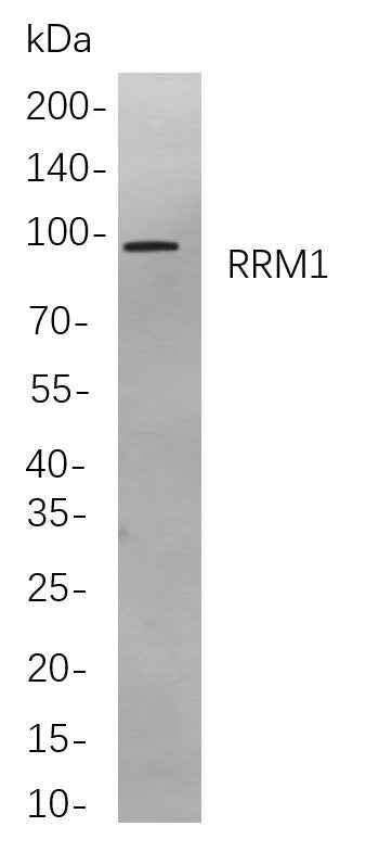 Anti-Human/Mouse/Rat RRM1 Antibody [B887] - ABMIUM