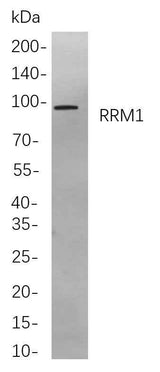 Anti-Human/Mouse/Rat RRM1 Antibody [B887]