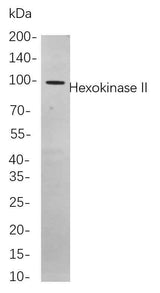 Anti-Human/Mouse/Rat Hexokinase II Antibody [B825]