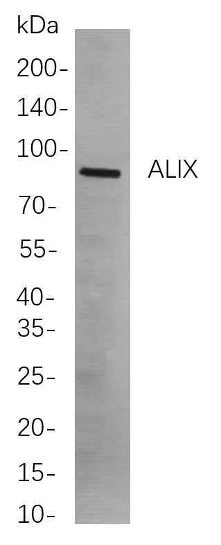 Anti-Human/Mouse/Rat ALIX Antibody [B859] - ABMIUM
