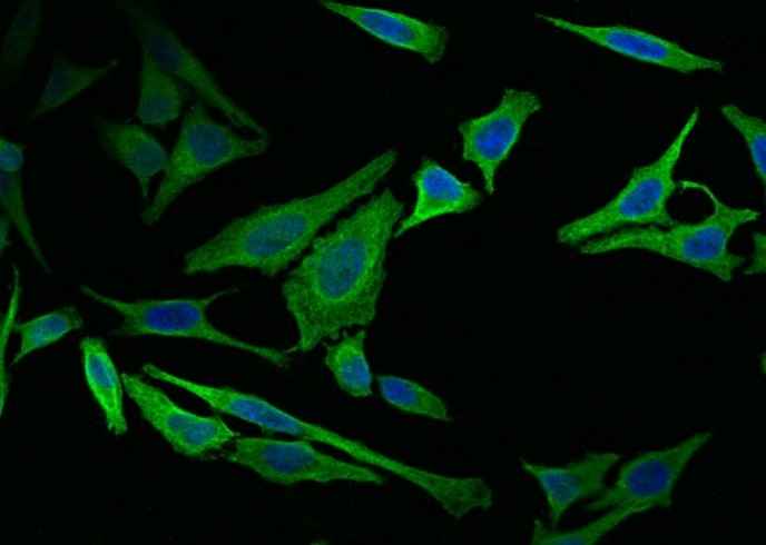 Anti-Human VIM Antibody [11G8] - ABMIUM