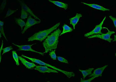 Anti-Human VIM Antibody [11G8] - ABMIUM