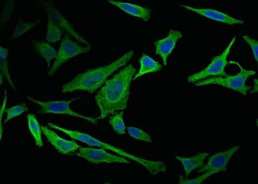 Anti-Human VIM Antibody [11G8] - ABMIUM