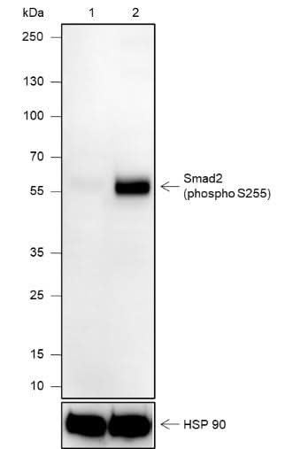 Anti-Human Phospho-Smad2 (S255) Antibody [A818] - ABMIUM