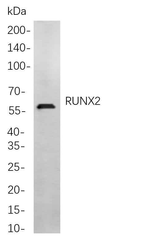 Anti-Human/Mouse/Rat RUNX2 Antibody [B813]