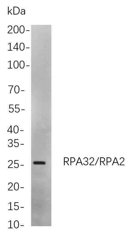 Anti-Human/Mouse/Rat RPA32/RPA2 Antibody [B702] - ABMIUM