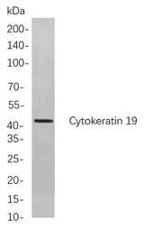 Anti-Human/Mouse/Rat Cytokeratin 19 Antibody [B867]