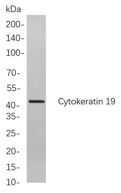 Anti-Human/Mouse/Rat Cytokeratin 19 Antibody [B867] - ABMIUM