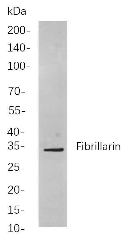 Anti-Human/Mouse/Rat Fibrillarin Antibody [B826] - ABMIUM