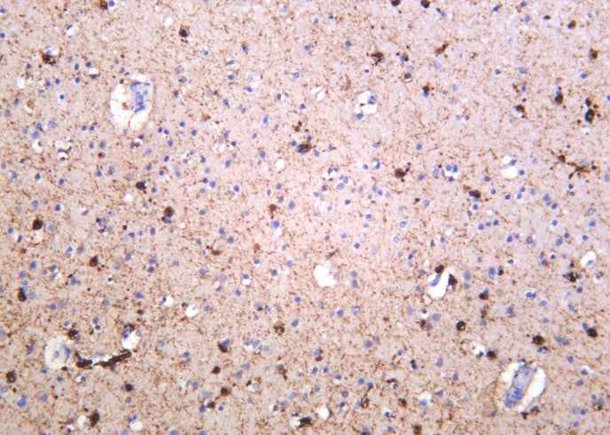 Anti-Human/Mouse/Rat NMDAR1 Antibody [B1052] - ABMIUM