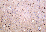 Anti-Human/Mouse/Rat NMDAR1 Antibody [B1052]