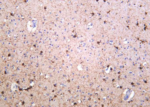 Anti-Human/Mouse/Rat NMDAR1 Antibody [B1052] - ABMIUM