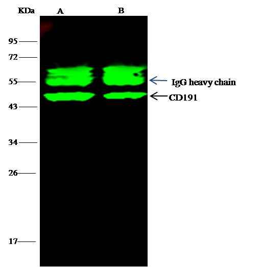 Anti-Human CCR1 Antibody [A1285] - ABMIUM