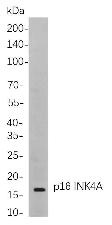 Anti-Human/Mouse/Rat p16 INK4A Antibody [8C2] - ABMIUM