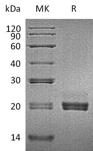 Recombinant Mouse CD40LG/TNFSF5 Protein (His Tag) - ABMIUM